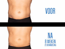 afvallen buikvet