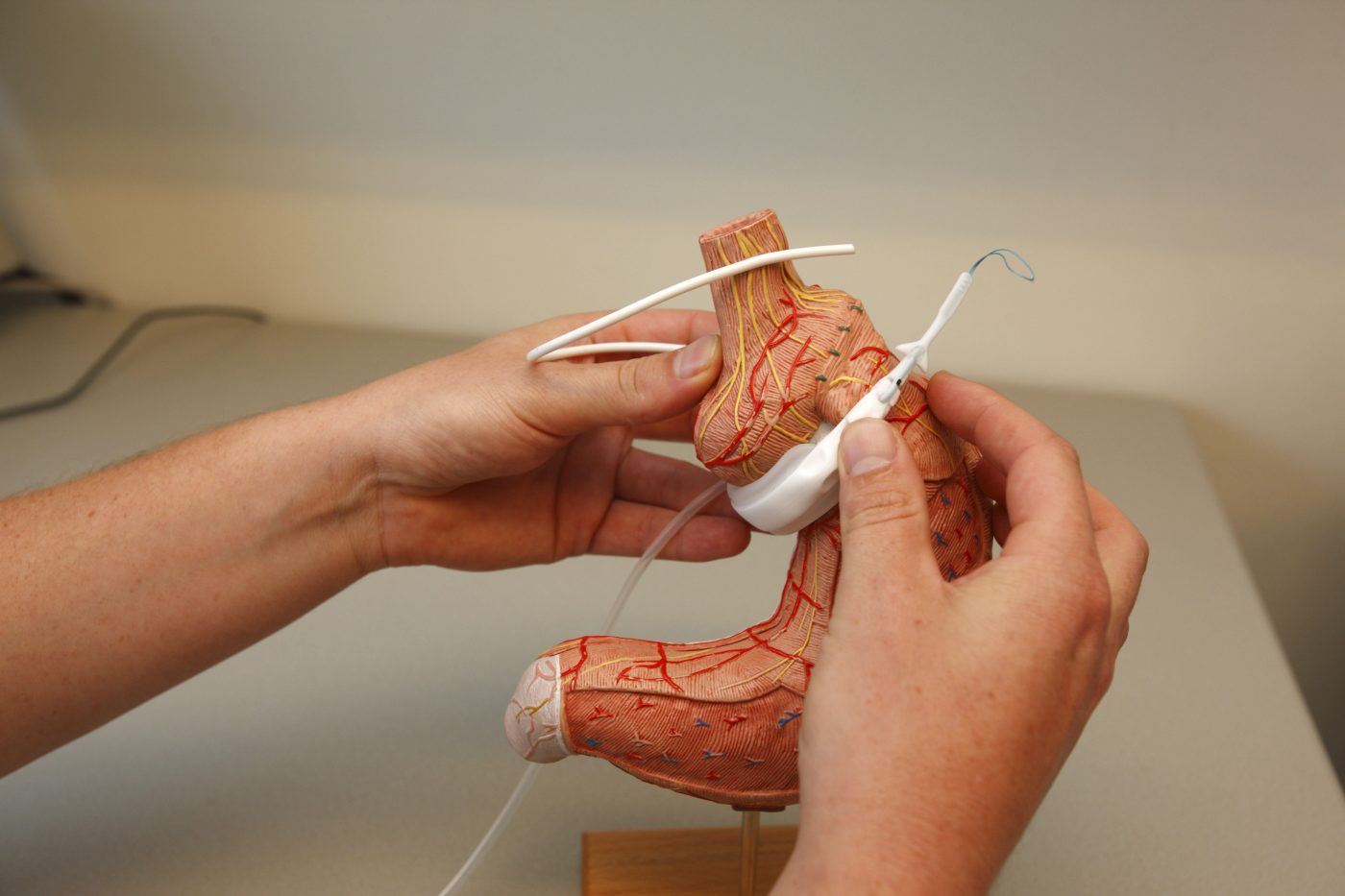 afvallen met hypnose