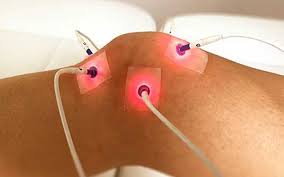 afvallen acupunctuur